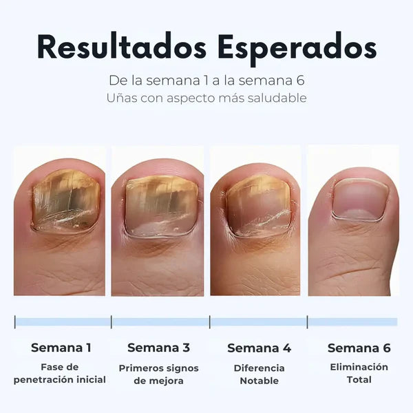 FUNGAL NAIL PATCHES - PARCHES ANTIHONGOS DE RENOVACIÓN PROFUNDA